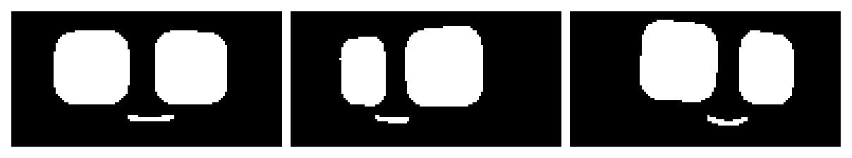 The same head-turn performance, three moments apart: centred, turning, and fully turned. The far eye shrinks and slides toward the centreline instead of just sliding sideways — that foreshortening is the whole point of this document.